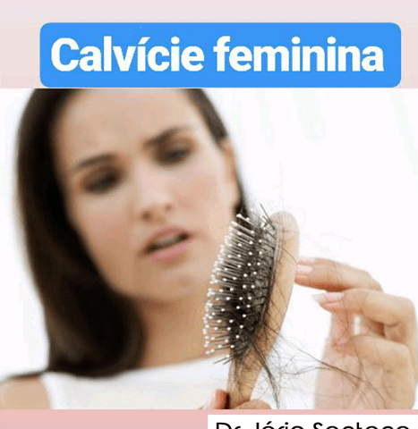 Calvície Feminina