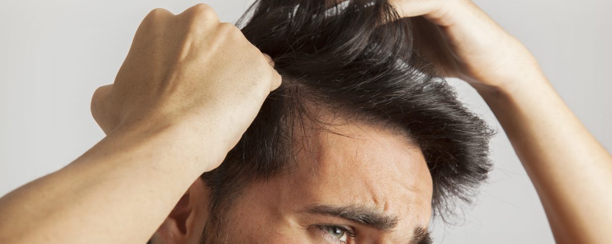 A alopecia cicatricial é uma condição que destrói permanente o folículo piloso, deixando uma cicatriz e fibrose no couro cabeludo. Saiba mais nesse artigo.