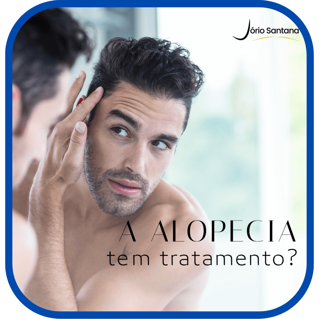 A alopecia tem tratamento? Dr Jorio Santana